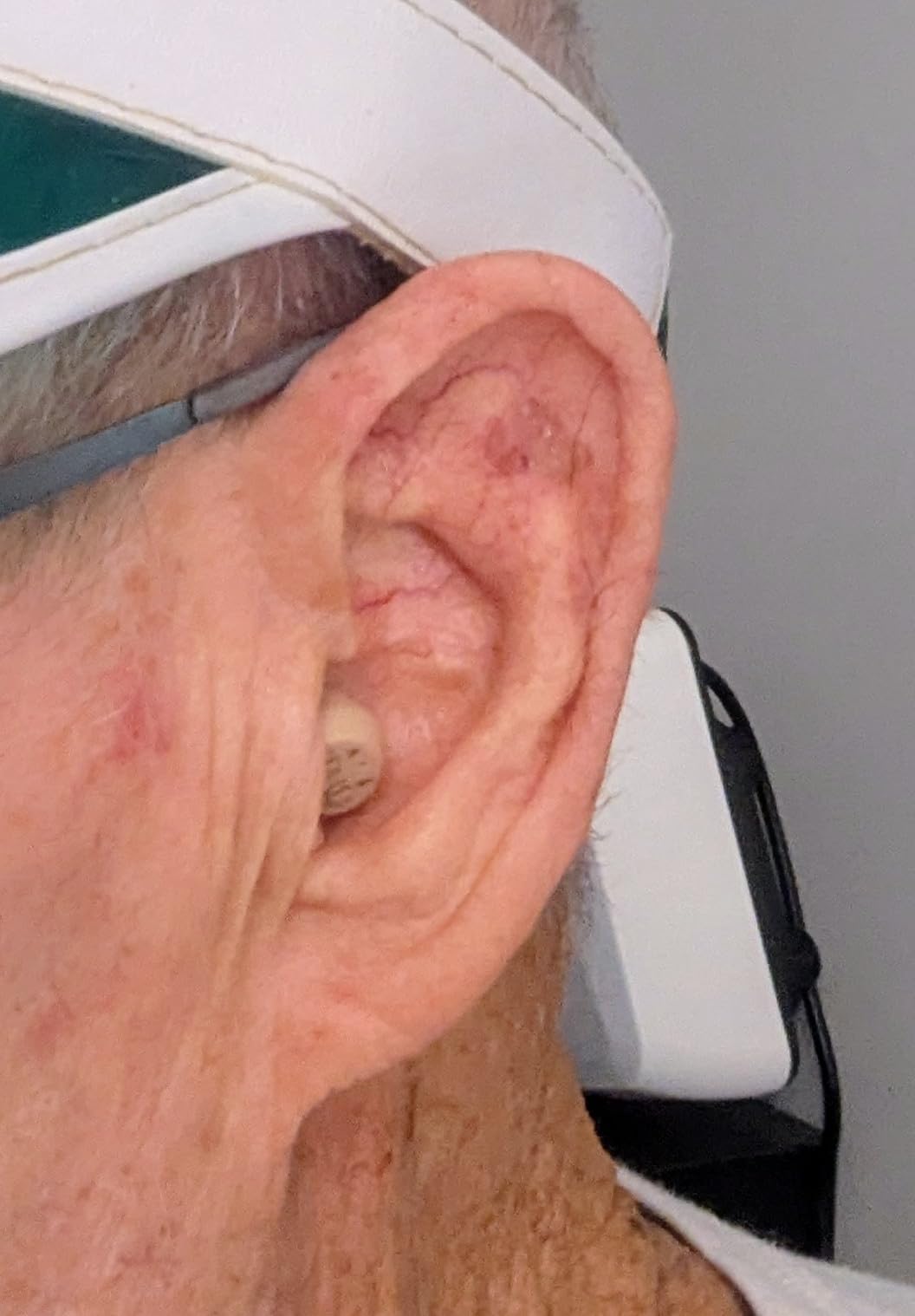 Audien Atom One OTC Hearing Aids customer photo 2